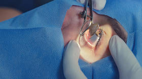 Have you ever wondered what a sliced eye looks like? (PHOTO)
