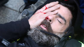 â€˜I'll lose my eyeâ€™: Prominent Yellow Vest activist suffers HORRIFIC injury in Paris protests