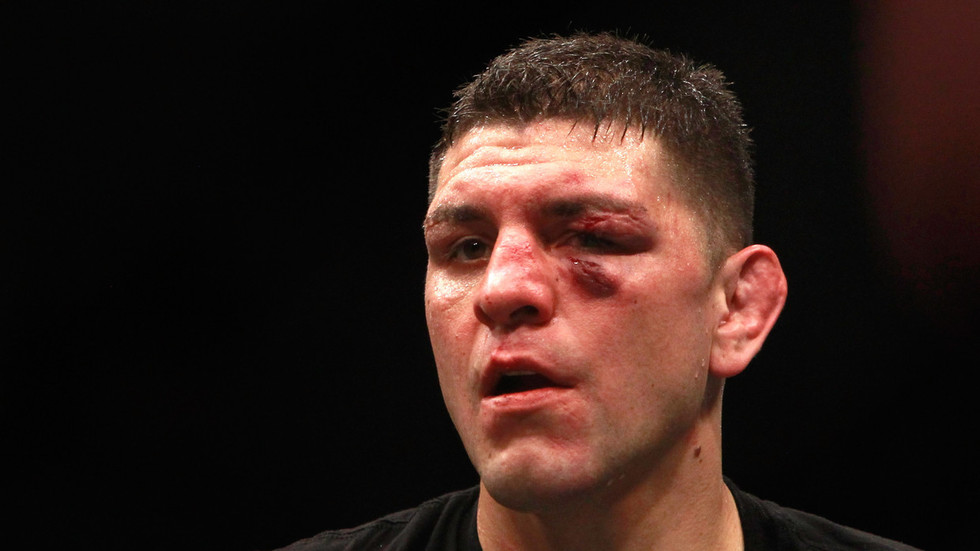 'Last time I checked he's retired': Nick Diaz's fight ...
