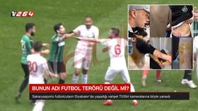 Turkey ‘razor attack’ footballer hit with travel ban as investigation launched