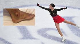 Price of success: Olympic champ Zagitova skated with severe blisters at nationals, photos reveal