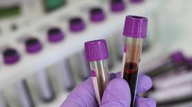 It’s in your blood: New Alzheimer’s test lets doctors detect dementia in ‘under 1 hour’