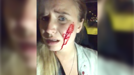 Hopping mad farmers &lsquo;open fire&rsquo; on vegan activists who killed 100 rabbits at farm in Spain (VIDEO)