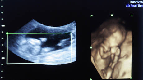 US abortion doctor stashed over 2,000 ‘preserved’ fetal remains at his house