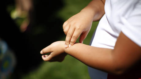 Saving lives or chasing dollars? Concern as doctors push stomach surgeries for children to combat rising obesity