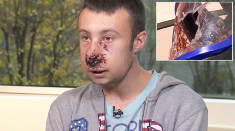 French police use ‘weapons of war’ against protesters: Journalist tells RT how tear gas grenade exploded in his face
