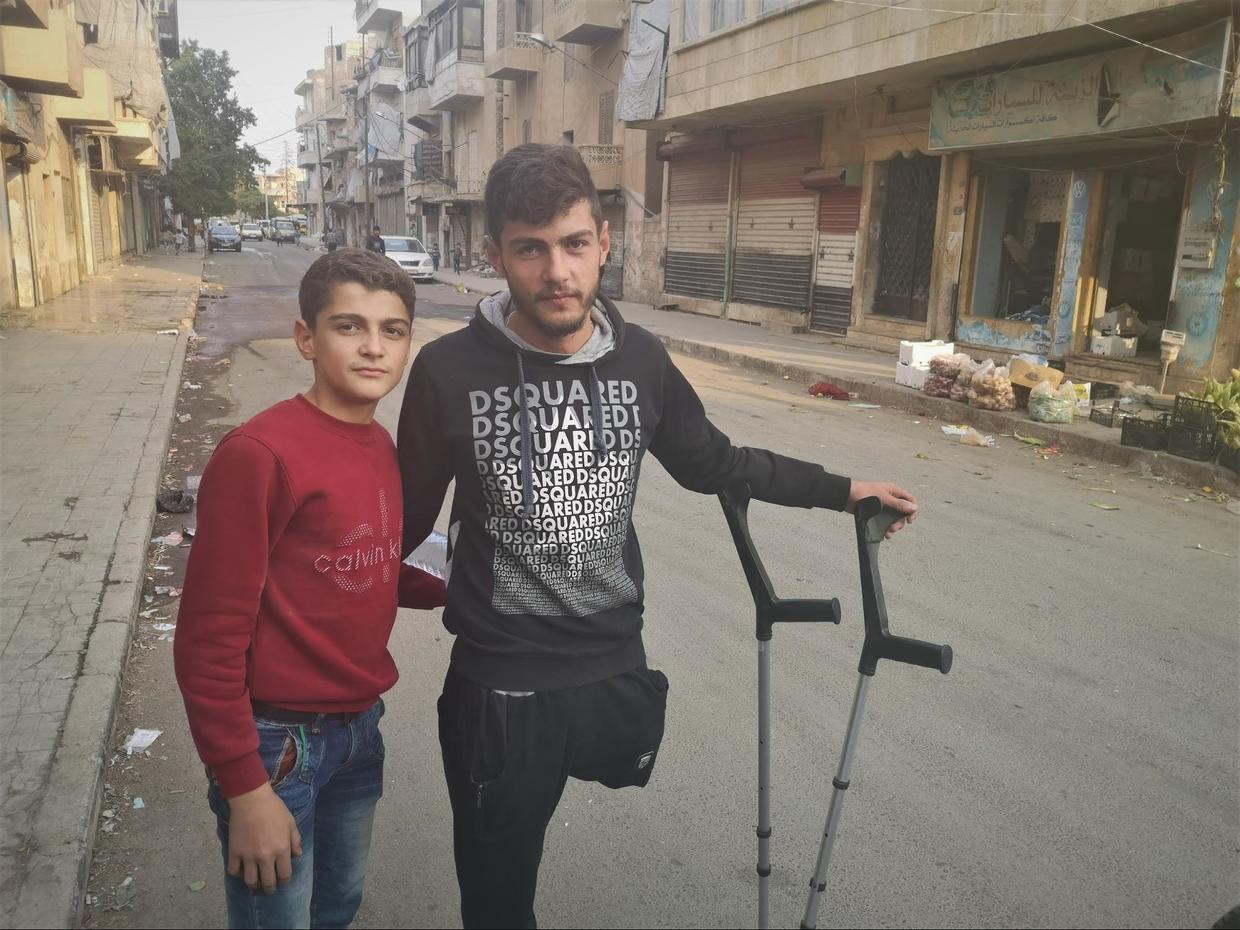 Hamoud is 19-years-old, his leg was blown off by a terrorist mortar three years ago, in Khalidiyah, Aleppo ©  Vanessa Beeley