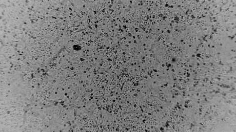 Frightened 10yo girl forcibly tested for coronavirus in St. Petersburg – medics to be disciplined