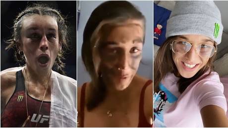 UFC’s Joanna Jedrzejczyk reveals remarkable transformation just days after shocking fans with horrendous facial bruising (PHOTOS)