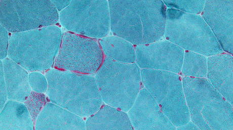 Illustration: © Wikipedia / Nephron