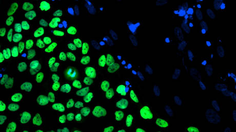 FILE PHOTO. A human embryonic stem cell line derived