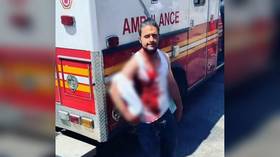 GRAPHIC VIDEO shows man walking around Harlem with knife stuck in his HEAD after violent altercation