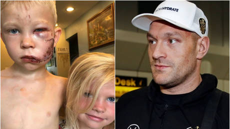 Bridger Walker with sister (left) and (right) Tyson Fury -Twitter; Getty