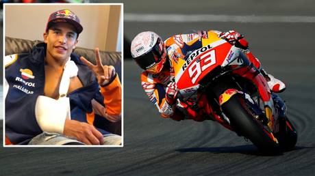 Injured: MotoGP world champion Marc Marquez