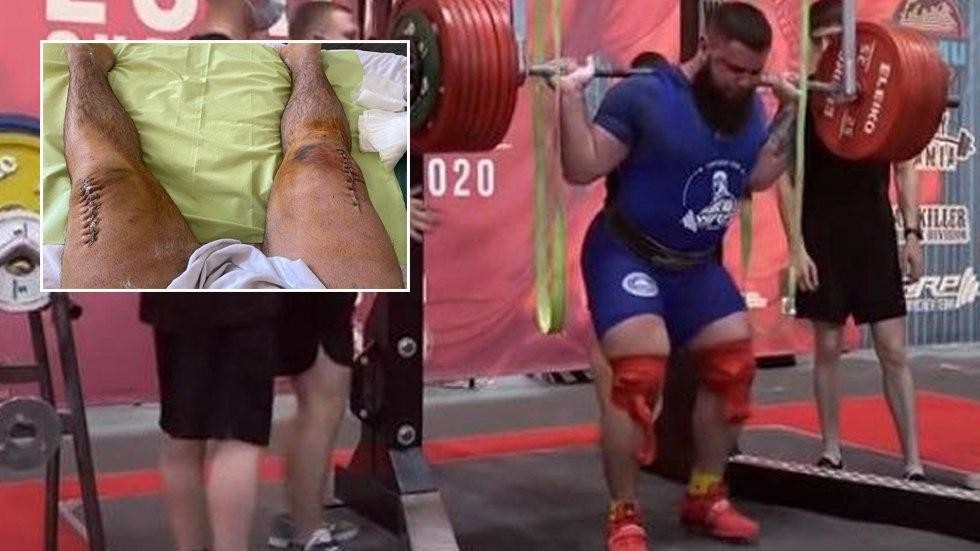 ‘Gross alert!’ Russian power lifter reveals HORRIFIC result of gruesome