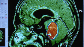 UK cancer charities warn of almost 50% Covid-induced drop in funding, but scientists worry virus itself may cause more tumors
