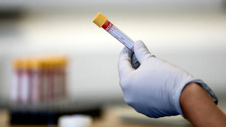 FILE PHOTO: A paramedic holds a test tube containing a blood sample during an antibody testing program in Birmingham, Britain, June 5, 2020 © Reuters / Simon Dawson