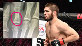 Breaking news: Khabib reveals X-ray scan of his agonizing BROKEN TOE taken SEVENTEEN DAYS before his UFC 254 victory over Gaethje