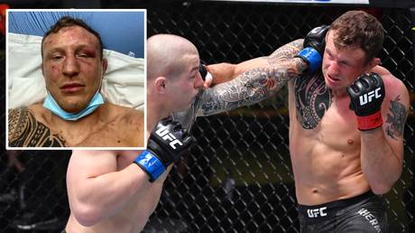 Down, but not out: UFC middleweight Jack Hermansson