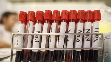 Unexpected side effect? Australia scraps Covid-19 vaccine development after trials lead to false positives for HIV