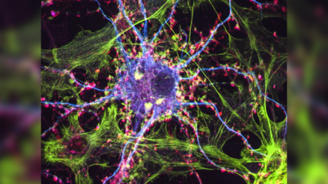 © Image of nerve cells by Lindsay Cameron, UC Davis.