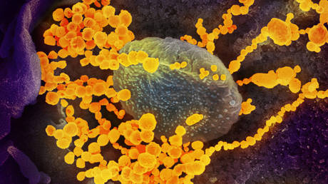 FILE PHOTO: An undated scanning electron microscope image shows SARS-CoV-2 (round gold objects), also known as novel coronavirus, isolated from a patient in the US. © Handout via REUTERS / NIAID-RML