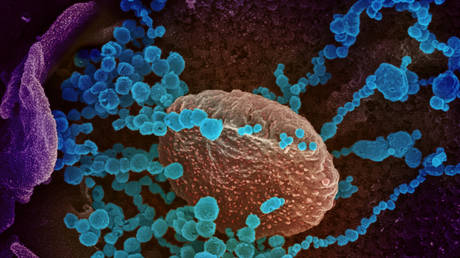 This scanning electron microscope image shows SARS-CoV-2 (round blue objects), which was isolated from a patient in the US (FILE PHOTO) © NIAID-RML/Handout via REUTERS.