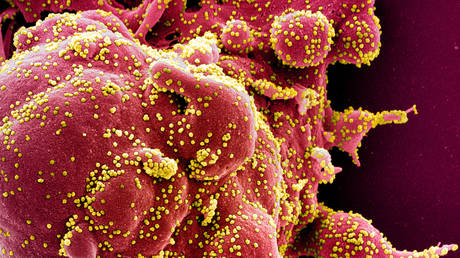 FILE PHOTO: Colorized scanning electron micrograph of an apoptotic cell (red) infected with SARS-COV-2 virus particles (yellow). © National Institute of Allergy and Infectious Diseases, NIH / Handout via REUTERS