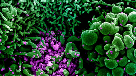 FILE PHOTO: An undated colorized scanning electron micrograph of an apoptotic cell (green) heavily infected with SARS-COV-2 virus particles (purple). © NIAID Integrated Research Facility (IRF) / Handout via REUTERS