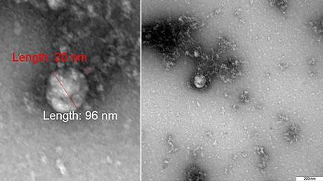 Siberian scientists photograph &lsquo;British variant&rsquo; of Covid-19 for first time while studying structure in significant breakthrough