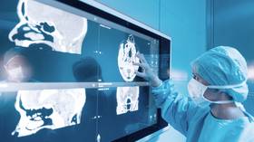 Researchers warn of brain damage from coronavirus infection after finding stroke-like complications in Covid victims