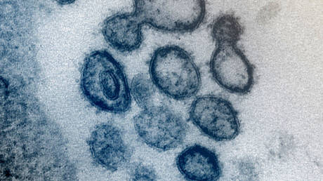 SARS-CoV-2 – the virus that causes Covid-19 – isolated from a patient in the US. © NIAID-RML