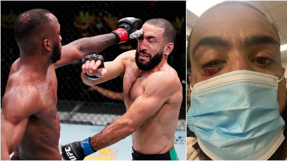 UFC fans and fighters demand action as SICKENING eye-poke causes Edwards-Muhammad clash to end in no contest 1 UFC fans and fighters demand action as SICKENING eye-poke causes Edwards-Muhammad clash to end in no contest