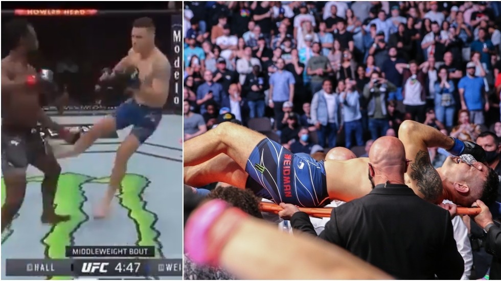 chris weidman leg break pictures chris weidman leg break pictures