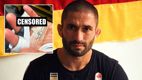 MMA fighter Khetag Pliev lost a finger in a fight © Twitter / TimWheatonMMA | © Instagram / khetag_pliev
