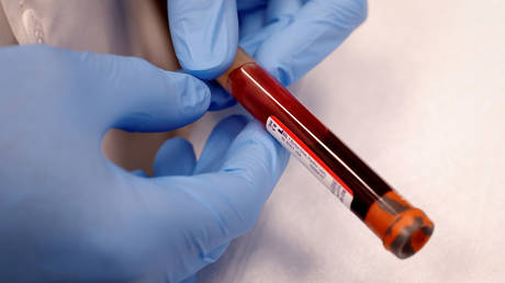 Blood-injecting beauty salon owner charged after clients allegedly catch HIV from &lsquo;vampire facials&rsquo;