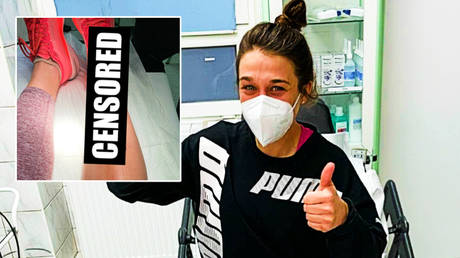 Joanna Jedrzejczyk needed treatment on a gruesome training injury © Instagram / joannajedrzejczyk