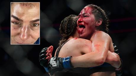 &lsquo;Hard as nails&rsquo;: Blood-soaked UFC fighter & OnlyFans star Jessica Eye STICKS OUT TONGUE after suffering horror wound (GRAPHIC)