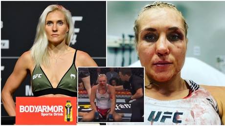 ‘Life goes on’: Battered Russian UFC beauty Yana ‘Foxy’ Kunitskaya issues apology and posts bloody hospital selfie after defeat