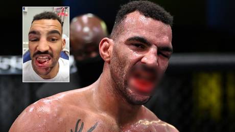 Warning &ndash; cannot be unseen: UFC fighter Clark defies HORRIFIC damage to teeth to complete fight (PHOTOS)