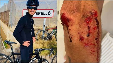 &lsquo;Becoming common occurrence in London&rsquo;: Brit cycling star left bloodied after being robbed of $14K bike by machete-wielding thugs
