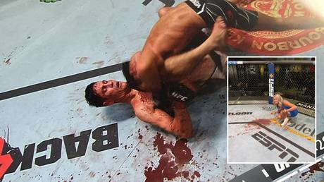 &lsquo;You can smell the blood from here&rsquo;: UFC fighter suffers grotesque forehead gash&hellip; wins fight anyway (GRAPHIC)