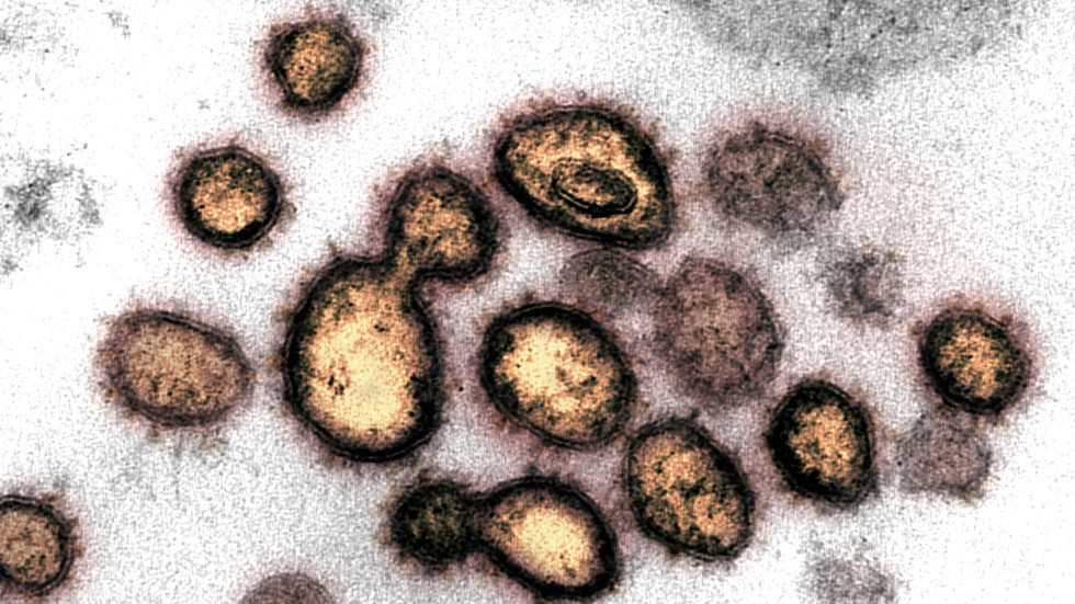 <div class=__reading__mode__extracted__imagecaption>FILE PHOTO: An electron microscope image shows SARS-CoV-2, the virus that causes Covid-19, isolated from a patient in the US. ©&#160;Reuters / NIAID-RML handout