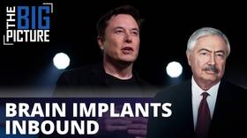 Brain implants inbound: In Musk we trust?