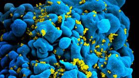 HIV can be fooled into an ambush by killer cells – study