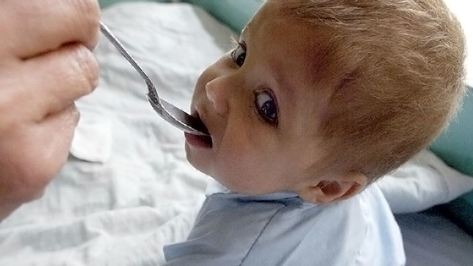 Overmedicated from the cradle: More than 10k US toddlers prescribed drugs for ADHD