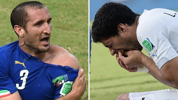 Jaws and scores: Suarez and other bite-crazy athletes (VIDEO)