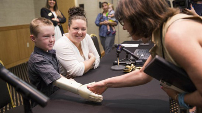 ‘I can now climb trees’: 6yo kid gets prosthetic arm from 3D printer