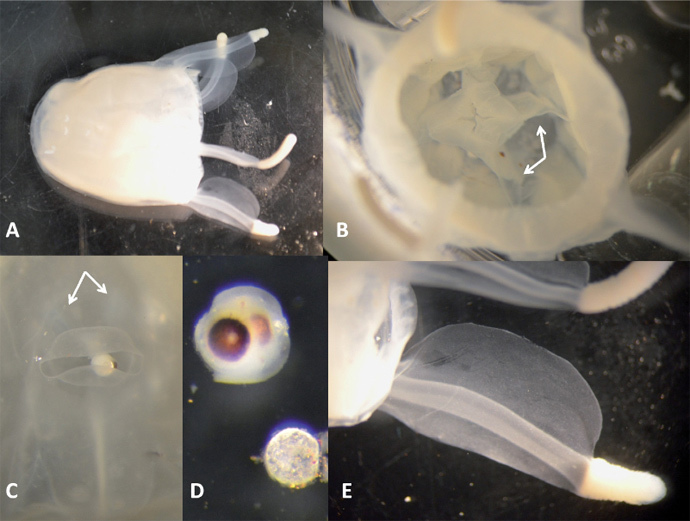 Malo bella sp. nov., holotype. A. habitus. B. subumbrellar view of mesenteries (indicated by arrows) and manu-brium. C. rhopaliar niche (rhopaliar horns are indicated by arrows); note also perradial lappets with irregular nematocyst warts in lower centre of image. D. rhopalium (above) and statolith (below), dissected away from specimen and rotated such that left side of image would be âdownâ in life; note absence of lateral eye spots. E. pedalium. (image from http://museum.wa.gov.au)