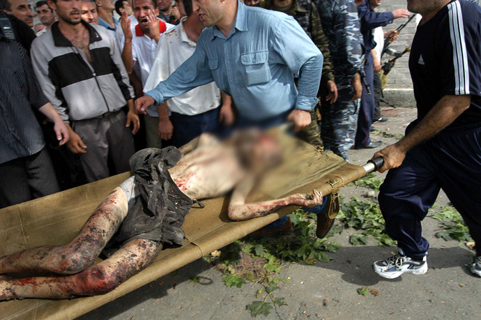 Ossetian volunteers carry a stretcher with injured boy in the school garden during the attack operation in the town of Beslan, North Ossetia, 03 September 2004. (AFP Photo/Yuri Tutov)